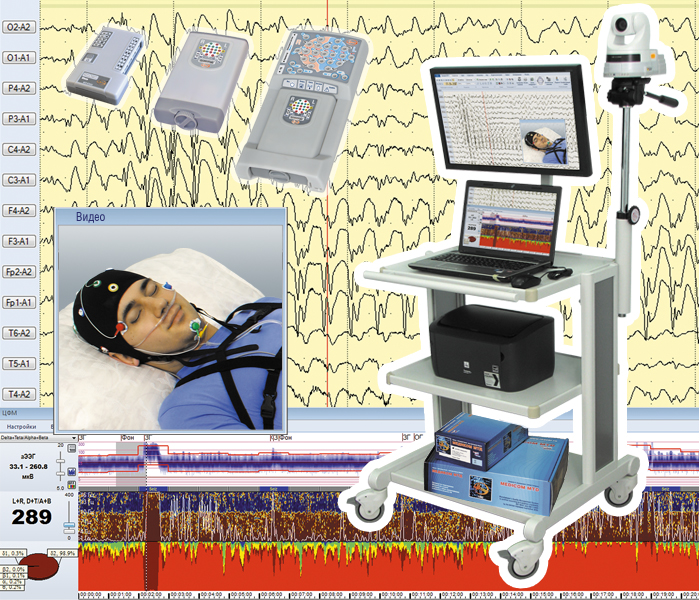 Комплект видеооборудования для ЭЭГ-видеомониторинга и ПМО «Энцефалан-Видео»