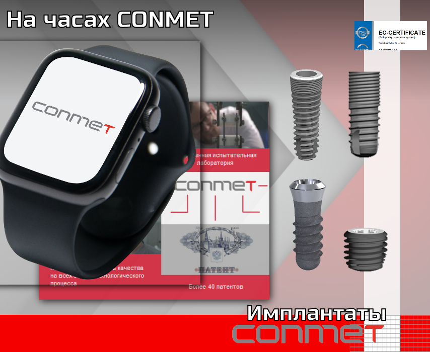 На часах CONMET