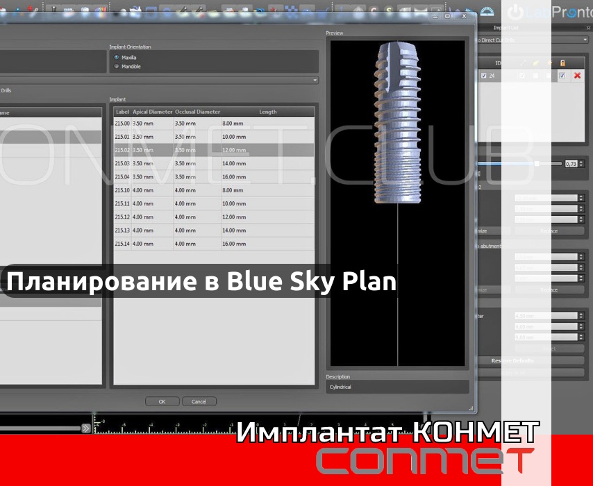 Планирование операций по дентальной имплантации в программе Blue Sky Plan на имплантатах КОНМЕТ!