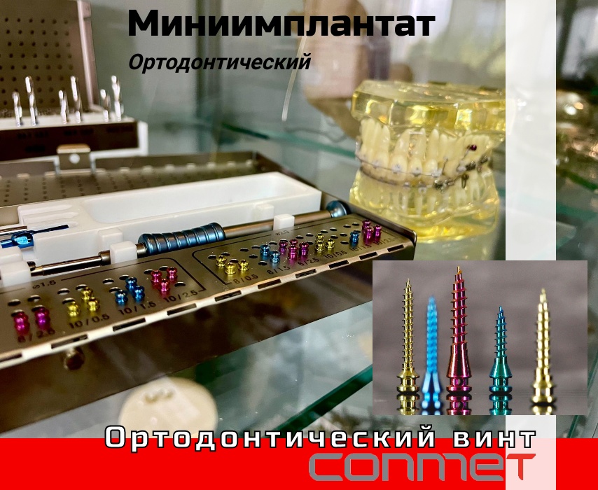 Минииплантаты ортодонтические - КОНМЕТ!